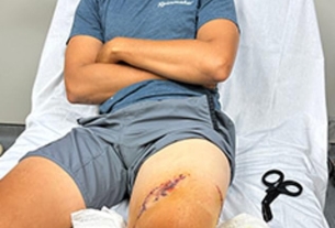 Florida man describes lucky escape after being mauled by TWO sharks when he slipped off a boat in the Bahamas